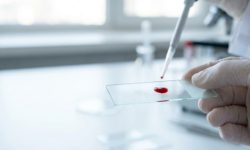 Инвазивная пневмококковая инфекция указывала на скрытый иммунодефицит