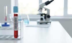 Низкий уровень тестостерона повышал риск смерти от рака у мужчин