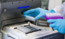 В СамГМУ разработали тест-систему для диагностики внутрибольничных инфекций