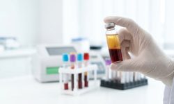 Ингибиторы фактора XIa снизили риск повторного инсульта без роста кровотечений