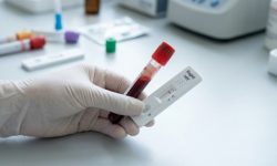 В России на один летальный исход от ВИЧ приходится 1,5 новых случая заражения